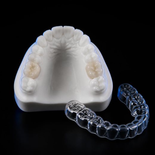 3D-printed Dental crowns & aligners