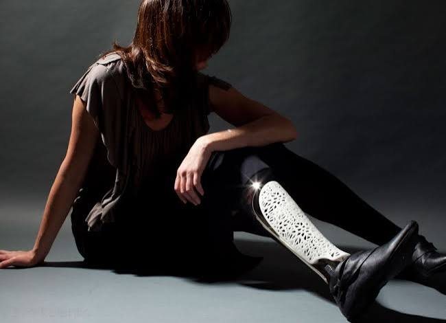 Personalised limb cover