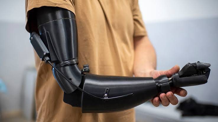 Upper-limb prosthesis