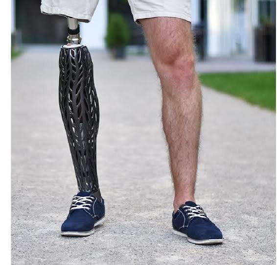 Prosthetic leg cover