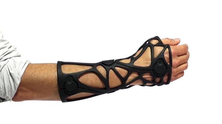 Ventilated wrist cast